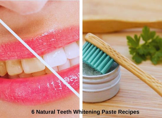 6 Natural Teeth Whitening Paste Recipes