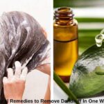 8 Natural Remedies to Remove Dandruff In One Wash