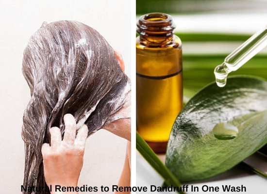 8 Natural Remedies to Remove Dandruff In One Wash